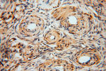 GSTT1 Antibody in Immunohistochemistry (Paraffin) (IHC (P))