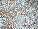 GSTT1 Antibody in Immunohistochemistry (Paraffin) (IHC (P))