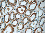 GSTT1 Antibody in Immunohistochemistry (Paraffin) (IHC (P))