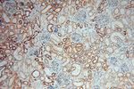 GSTT1 Antibody in Immunohistochemistry (Paraffin) (IHC (P))