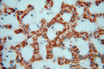 GSTT1 Antibody in Immunohistochemistry (Paraffin) (IHC (P))