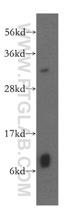 GSTT1 Antibody in Western Blot (WB)