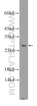 GSTT1 Antibody in Western Blot (WB)