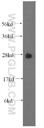 GSTT1 Antibody in Western Blot (WB)