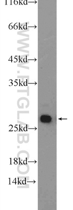 GSTT1 Antibody in Western Blot (WB)