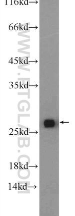 GSTT1 Antibody in Western Blot (WB)