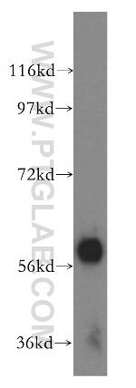 Amylase alpha Antibody in Western Blot (WB)