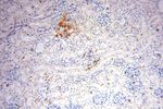 TGM4 Antibody in Immunohistochemistry (Paraffin) (IHC (P))