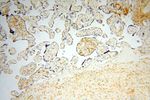 TGM4 Antibody in Immunohistochemistry (Paraffin) (IHC (P))