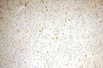 TGM4 Antibody in Immunohistochemistry (Paraffin) (IHC (P))