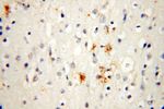 TGM4 Antibody in Immunohistochemistry (Paraffin) (IHC (P))