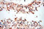 TGM4 Antibody in Immunohistochemistry (Paraffin) (IHC (P))