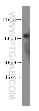 TGM4 Antibody in Western Blot (WB)