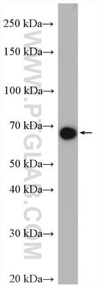 TGM4 Antibody in Western Blot (WB)