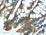 NDUFS4 Antibody in Immunohistochemistry (Paraffin) (IHC (P))