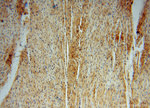 PYGL Antibody in Immunohistochemistry (Paraffin) (IHC (P))