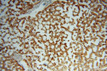 PYGL Antibody in Immunohistochemistry (Paraffin) (IHC (P))