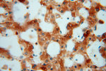 PYGL Antibody in Immunohistochemistry (Paraffin) (IHC (P))