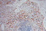 PYGL Antibody in Immunohistochemistry (Paraffin) (IHC (P))