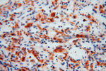 PYGL Antibody in Immunohistochemistry (Paraffin) (IHC (P))