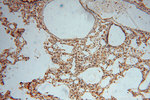 PYGL Antibody in Immunohistochemistry (Paraffin) (IHC (P))