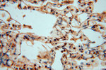 PYGL Antibody in Immunohistochemistry (Paraffin) (IHC (P))