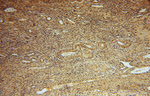 PYGL Antibody in Immunohistochemistry (Paraffin) (IHC (P))