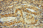 PYGL Antibody in Immunohistochemistry (Paraffin) (IHC (P))