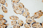 PYGL Antibody in Immunohistochemistry (Paraffin) (IHC (P))