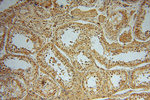 PYGL Antibody in Immunohistochemistry (Paraffin) (IHC (P))