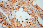 PYGL Antibody in Immunohistochemistry (Paraffin) (IHC (P))