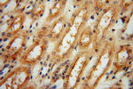 PYGL Antibody in Immunohistochemistry (Paraffin) (IHC (P))