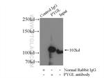 PYGL Antibody in Immunoprecipitation (IP)