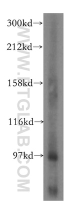 PYGL Antibody in Western Blot (WB)