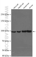 PYGL Antibody in Western Blot (WB)