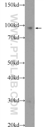 PYGL Antibody in Western Blot (WB)