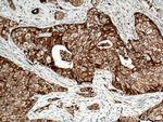 FXYD3 Antibody in Immunohistochemistry (Paraffin) (IHC (P))