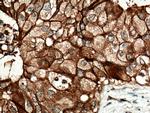 FXYD3 Antibody in Immunohistochemistry (Paraffin) (IHC (P))