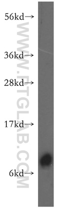 FXYD3 Antibody in Western Blot (WB)