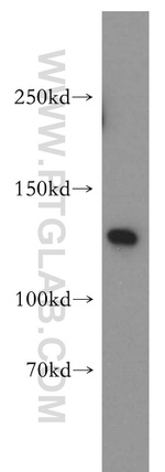 SF3A1 Antibody in Western Blot (WB)