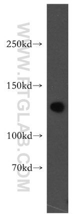 SF3A1 Antibody in Western Blot (WB)