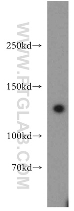 SF3A1 Antibody in Western Blot (WB)