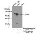 CAP2 Antibody in Immunoprecipitation (IP)