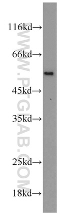 CAP2 Antibody in Western Blot (WB)