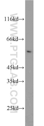 CAP2 Antibody in Western Blot (WB)