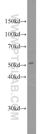 CAP2 Antibody in Western Blot (WB)