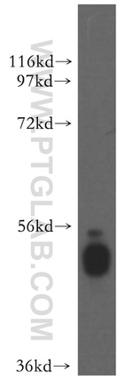 CAP2 Antibody in Western Blot (WB)