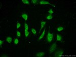 FABP4 Antibody in Immunocytochemistry (ICC/IF)