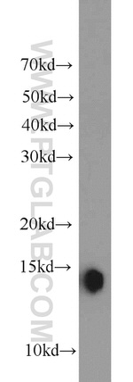 FABP4 Antibody in Western Blot (WB)