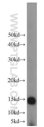 FABP4 Antibody in Western Blot (WB)